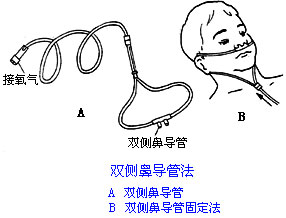 ◆肺病患者如何家庭氧療？